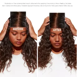 Kérastase Symbiose Bain Crème Anti-Pelliculaire Shampoo 250 Ml -Armani Salgsbutik kerastase symbiose bain creme anti pelliculaire shampoo 250 ml 1677063518