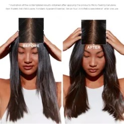 Kérastase Symbiose Bain Pureté Anti-Pelliculaire Shampoo 250 Ml -Armani Salgsbutik kerastase symbiose bain purete anti pelliculaire shampoo 250 ml 1677064576